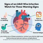 LVAD Wire Infection Risks: What Every Patient Should Know