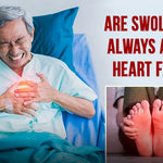 Are swollen feet always a sign of Heart Failure