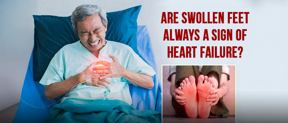 Are swollen feet always a sign of Heart Failure