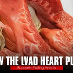 How the LVAD Heart Pump Supports Failing Hearts