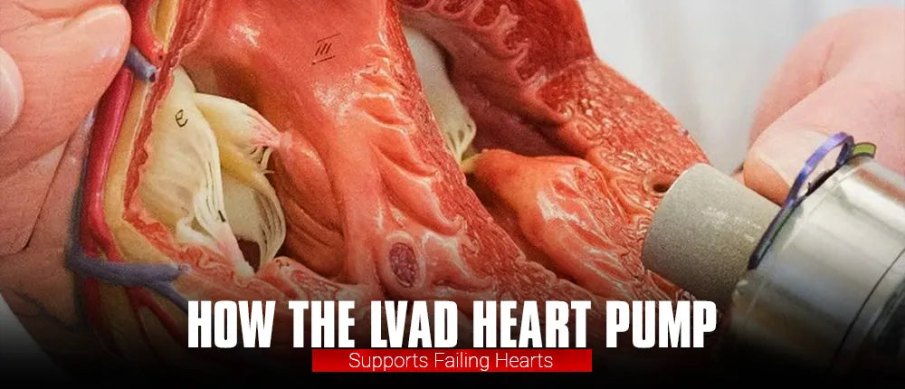 How the LVAD Heart Pump Supports Failing Hearts