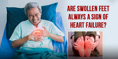 Are swollen feet always a sign of Heart Failure?