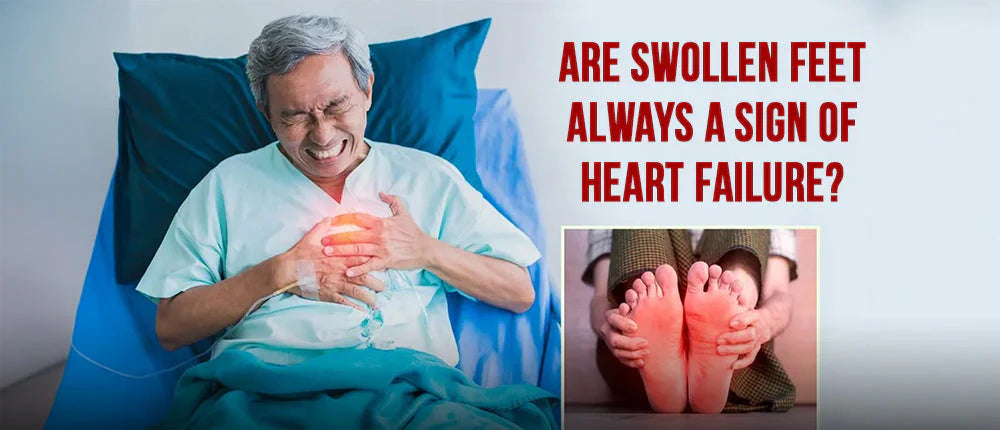Are swollen feet always a sign of Heart Failure?