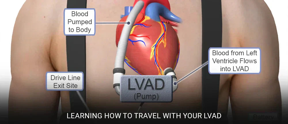 Learning how to travel with your LVAD