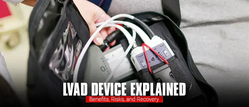 LVAD Device Explained: Benefits, Risks, and Recovery