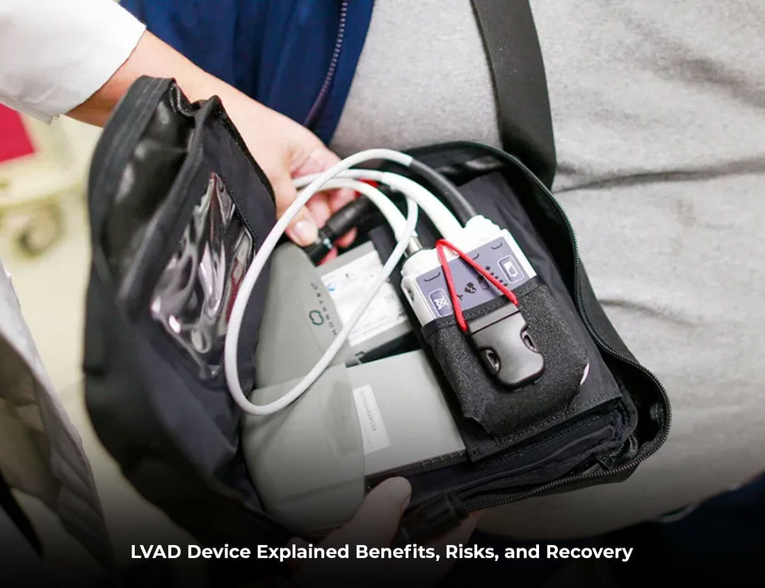 LVAD Device Explained: Benefits, Risks, and Recovery